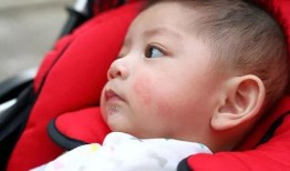 娱乐吃瓜酱过敏,吃瓜酱过敏背后的惊人真相